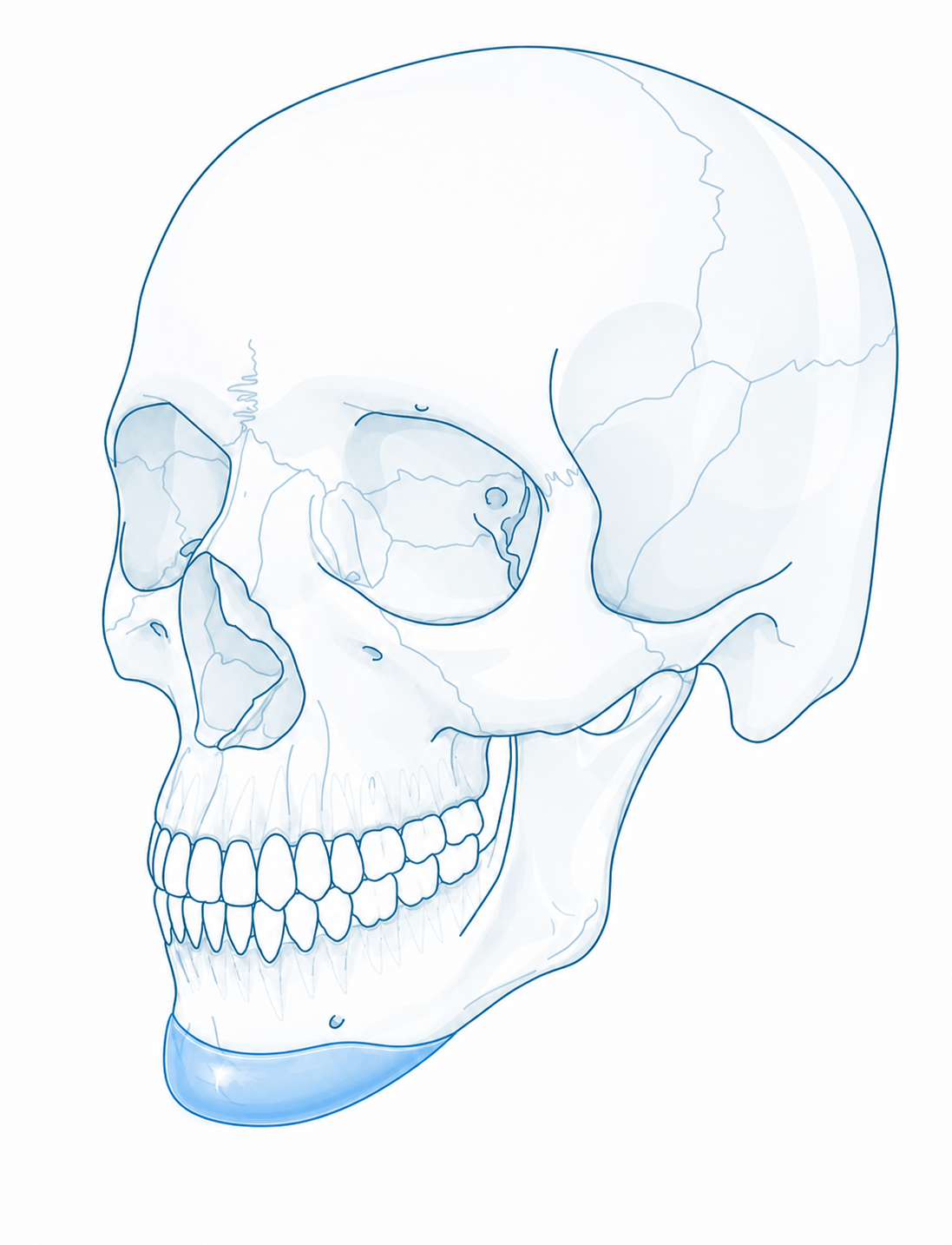Lateral skull with chin onlay