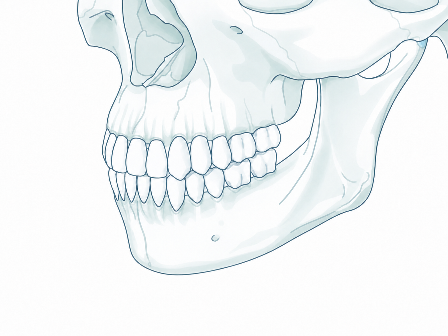 Genioplasty lateral baseline