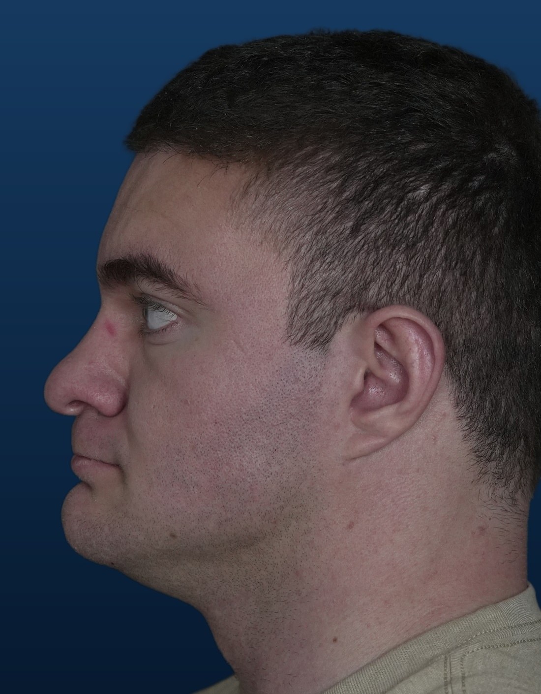 Before, profile