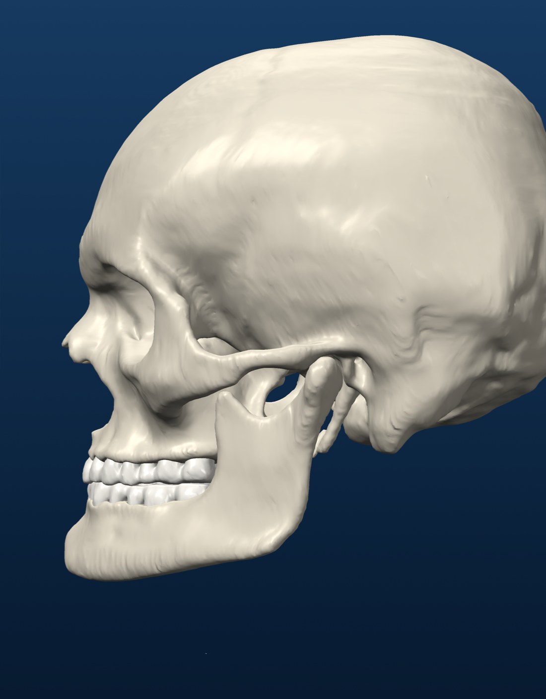 Pre-op skeleton