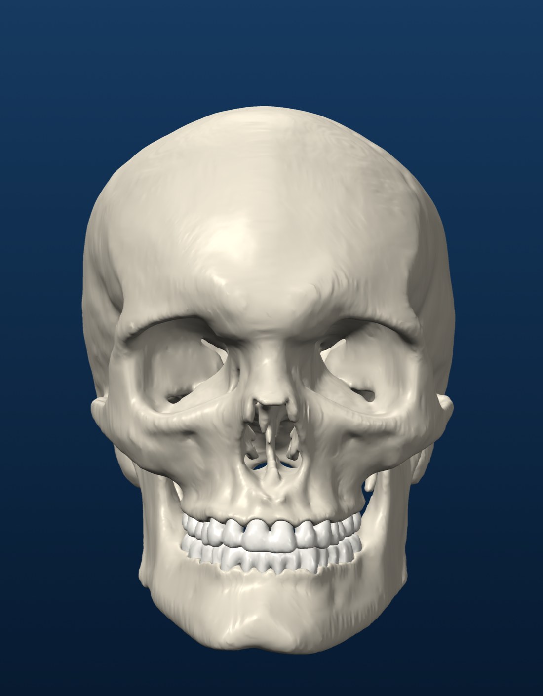 Pre-op skeleton, from the CT