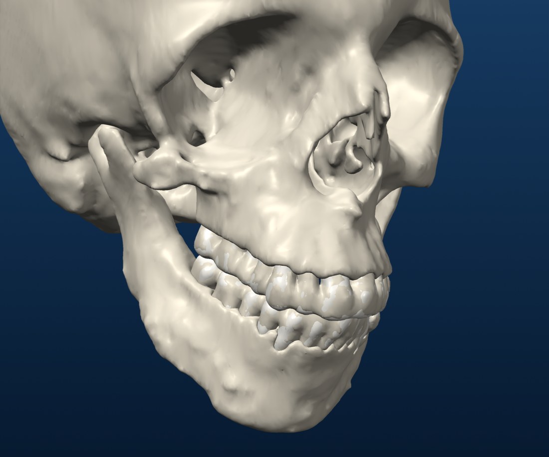 1 &middot; Pre-op
