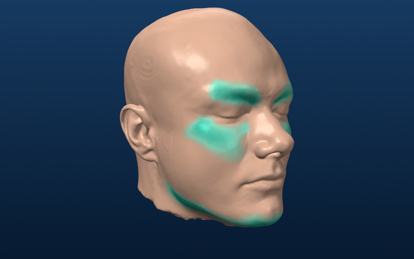 Predicted change of the skin over the implants