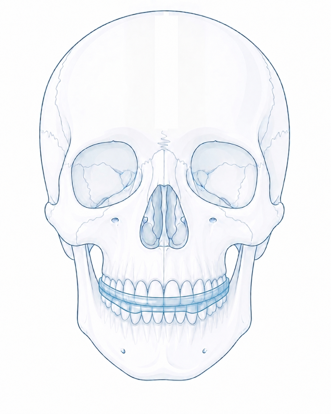 Frontal skull with transparent Michigan splint on the dental arches